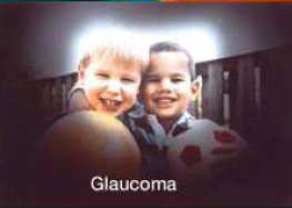 Glaucoma