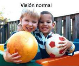 Vision normal