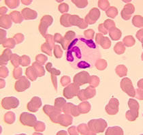 hematíes
