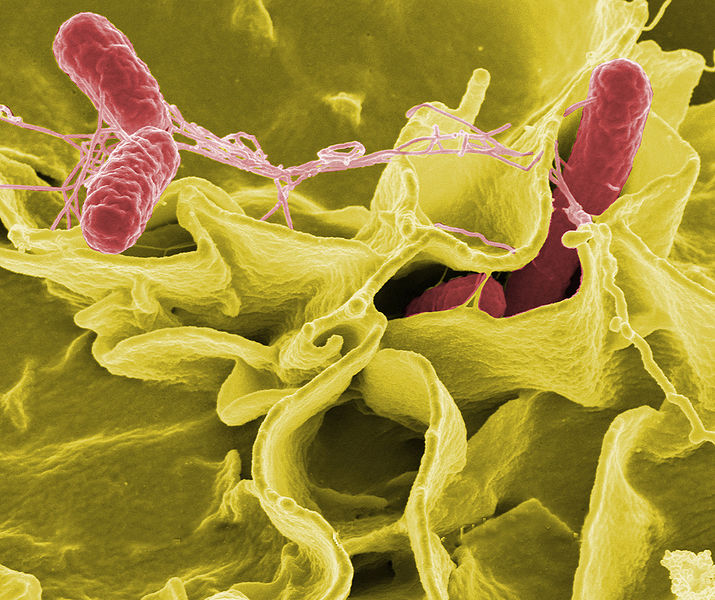 Micrografía electrónica de barrido con color mejorado que muestra Salmonella Typhimurium (rojo) invadiendo células humanas cultivadas. Esta bacteria es causante de la enfermedad denominada salmonelosis.
