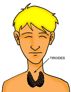 Tiroides Tiroides