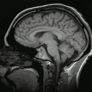 Secuencia animada de cortes sagitales del cerebro humano.