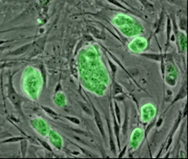 Microfotografía de células madre embrionarias de ratón teñidas con un marcador fluorescente verde.