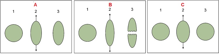 Tipos de deformación