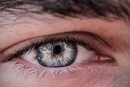 Ojo