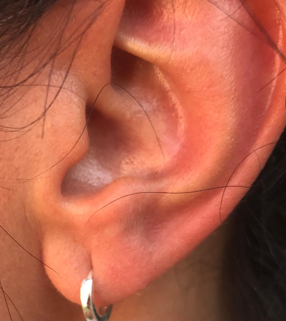 Oreja con pendiente 1