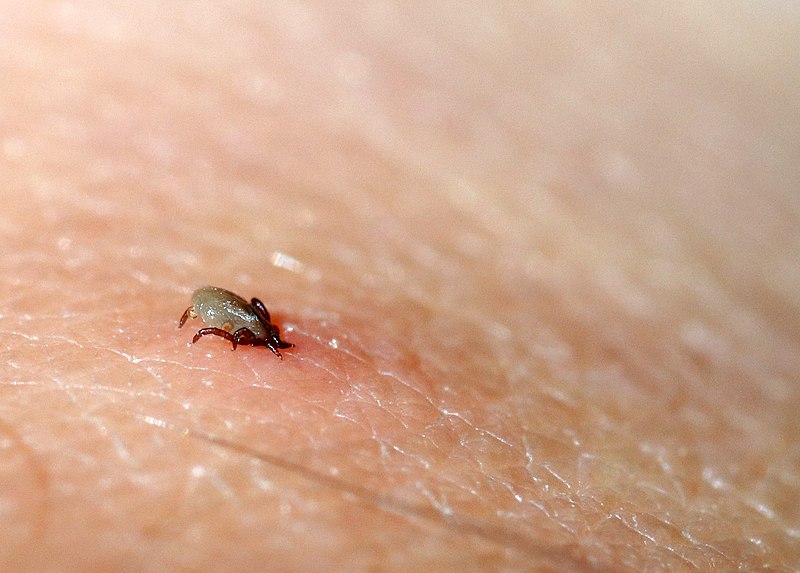 Imagen de un insecto causando una picadura en la piel.