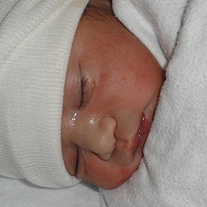 Rostro de un bebé dormido, con gorro de lana