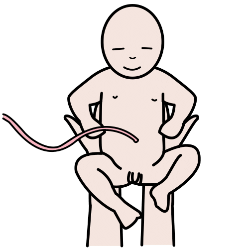Un bebé con el cordón umbilical