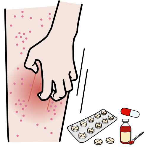La imagen muestra una pierna roja y diferentes medicamentos al fondo 