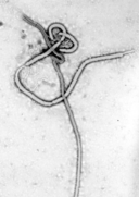 La imagen muestra el virus del ébola.
