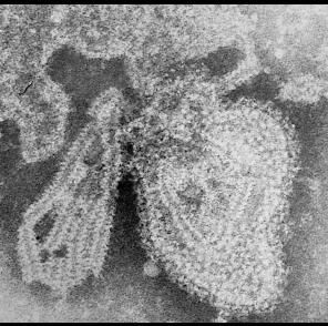La imagen muestra el virus de las paperas. 