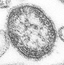 La imagen muestra el virus del sarampión.