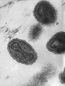 La imagen muestra el virus de la viruela.