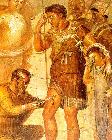 Mdico griego curando a un guerrero herido. Mosaico romano.