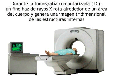Tomografa computerizada