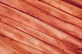Tejido muscular estriado. Las clulas son largas y cilndricas, denominndose fibras. Observa la estriacin que presentan las fibras.