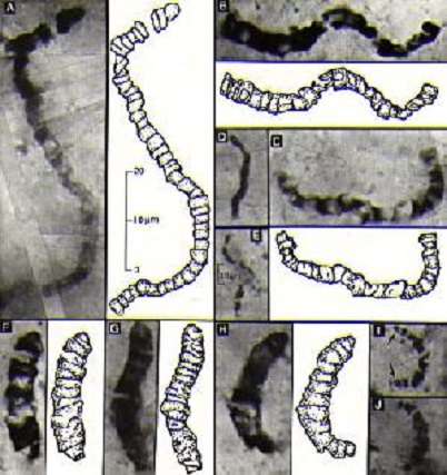 Cianobacterias o bacterias anaerobias