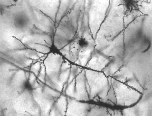 Neurona piramidal del hipocampo