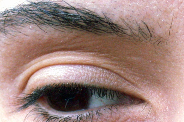 Ojo