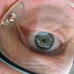 ojo