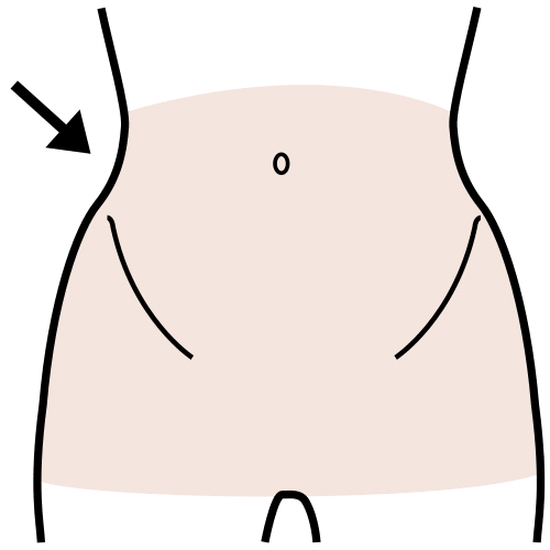 Dibujo de una pelvis femenina con flecha apuntando a la cadera