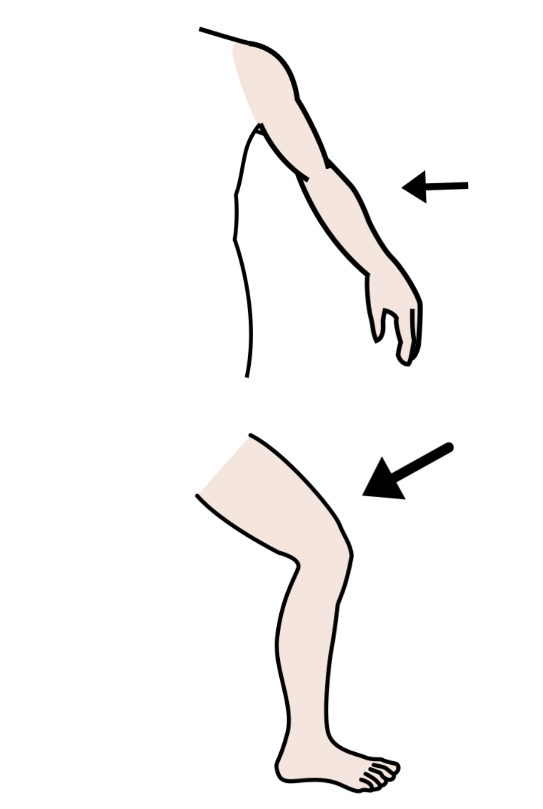 La imagen muestra un brazo y una pierna
