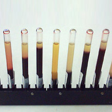 Sedimentación de muestras de sangre