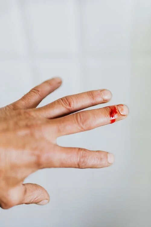 Finger bleeding