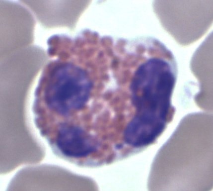 Eosinófilo